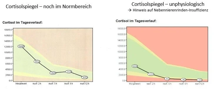 Cortisol Tagesprofil bei Heilpraktiker in Nürnberg